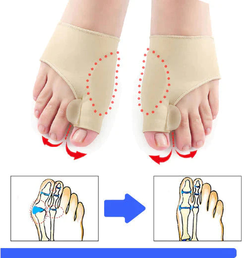 Meia Ortopédica FreeFeet - Corretor de Joanete Saúde & Beleza (Meia Ortopédica 1) Dm Stores 